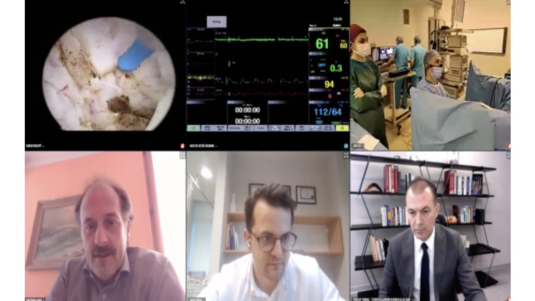 5G ile çevrim içi ameliyat